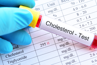 cholesterol blood test over chart listing cholesterol reading as high